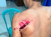 Cekcok Berujung Penganiayaan, Warga Bombana Diduga Ditebas Parang