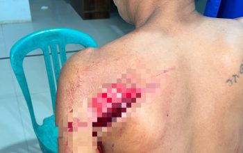 Cekcok Berujung Penganiayaan, Warga Bombana Diduga Ditebas Parang
