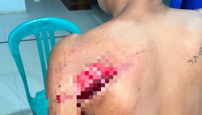 Cekcok Berujung Penganiayaan, Warga Bombana Diduga Ditebas Parang